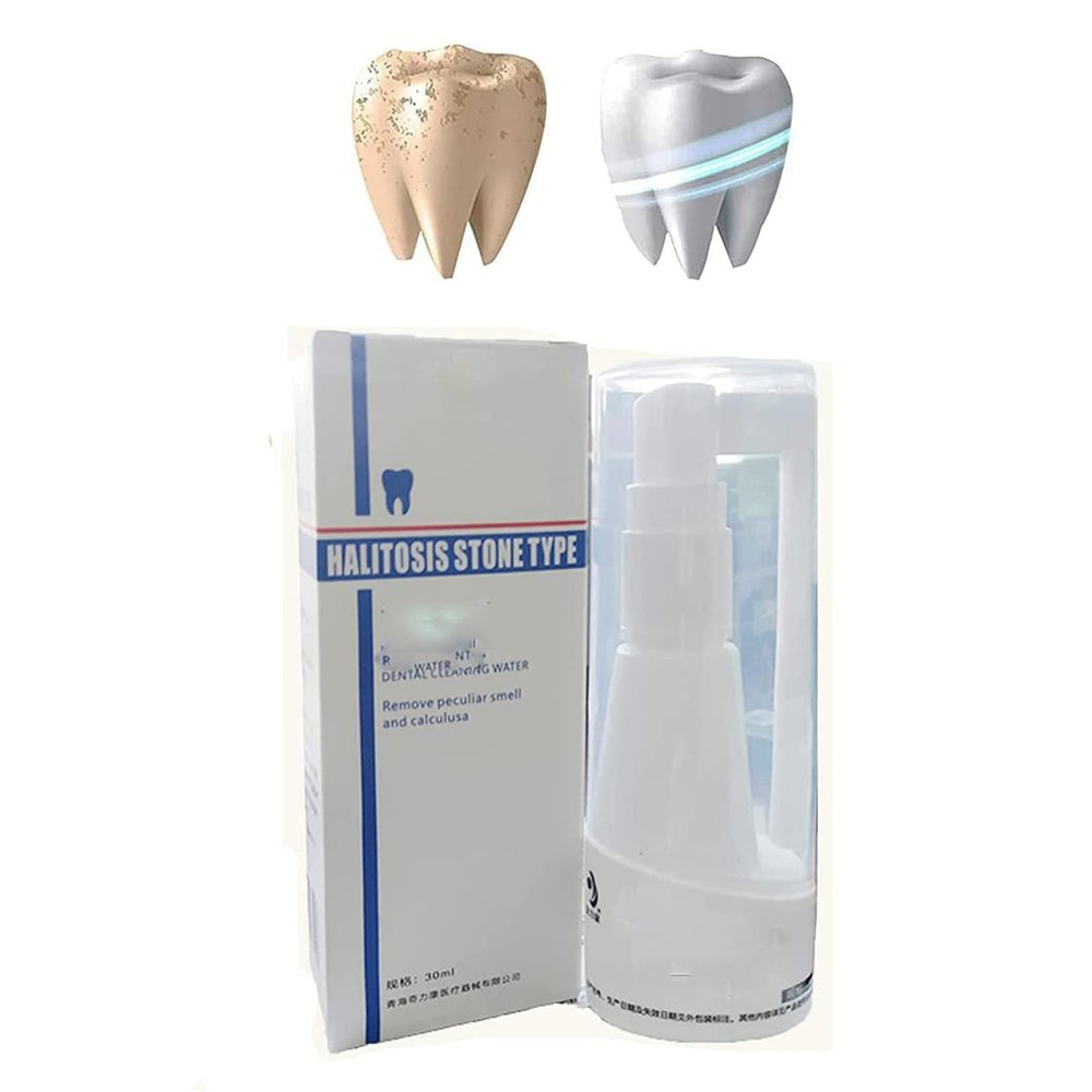 30ml Calculusfree Dissolving Dental Spray,Dental Calculus Remover Teeth Cleaner,Mouth Refreshing Spray,Plaque Remover for Teeth Mouthwash,Intensive Stain Removal Toothpaste (1pcs)