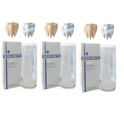 30ml Calculusfree Dissolving Dental Spray,Dental Calculus Remover Teeth Cleaner,Mouth Refreshing Spray,Plaque Remover for Teeth Mouthwash,Intensive Stain Removal Toothpaste (3pcs)