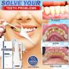 30ml Calculusfree Dissolving Dental Spray,Dental Calculus Remover Teeth Cleaner,Mouth Refreshing Spray,Plaque Remover for Teeth Mouthwash,Intensive Stain Removal Toothpaste (3pcs) view 2