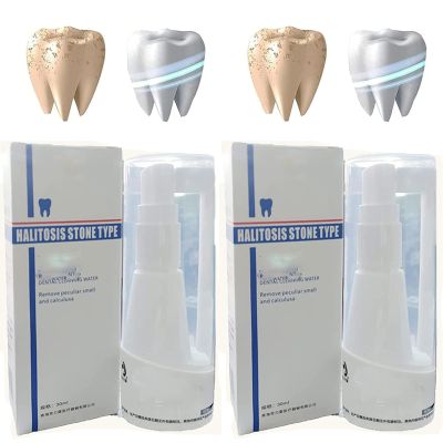 30ml Calculusfree Dissolving Dental Spray,Dental Calculus Remover Teeth Cleaner,Mouth Refreshing Spray,Plaque Remover for Teeth Mouthwash,Intensive Stain Removal Toothpaste (2pcs)