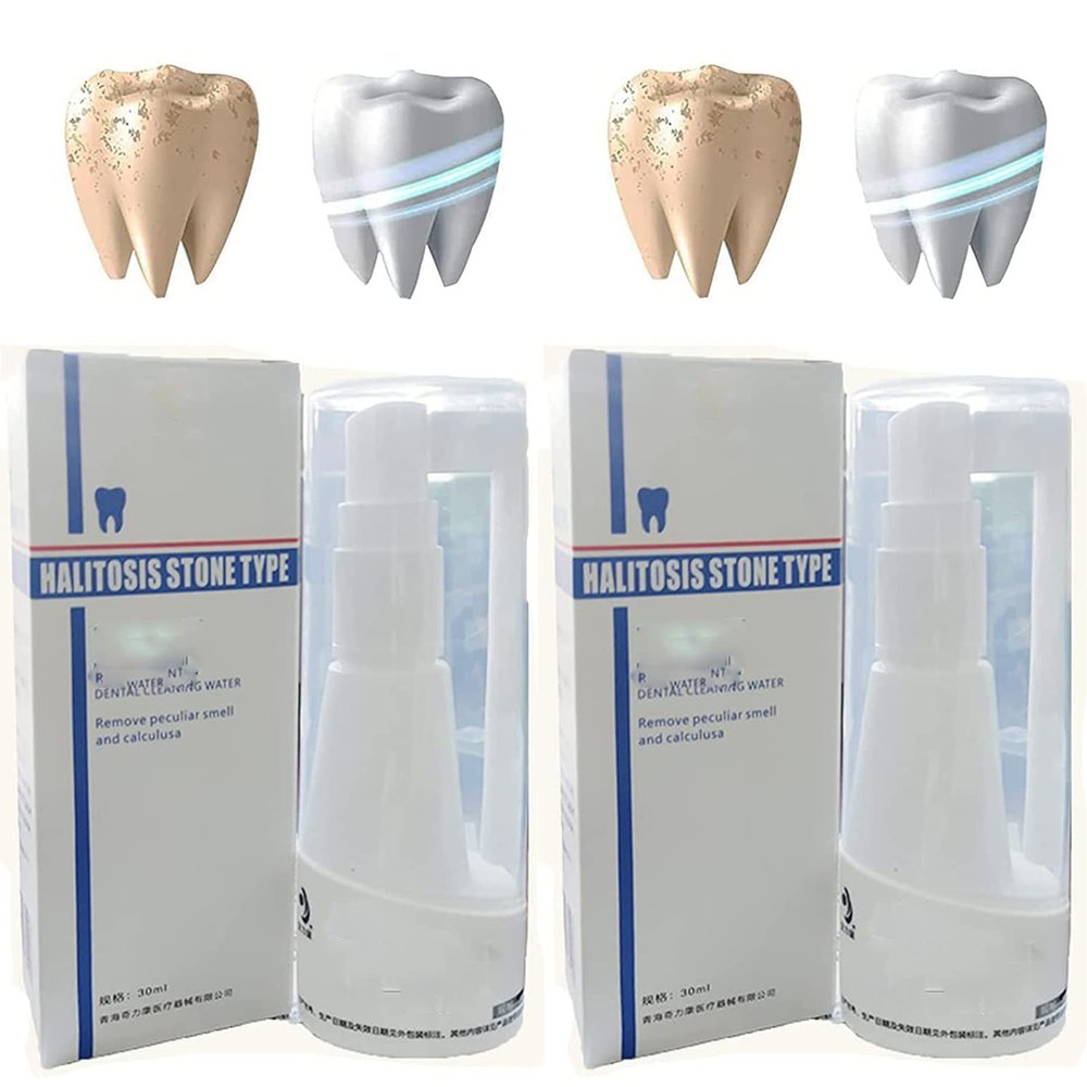 30ml Calculusfree Dissolving Dental Spray,Dental Calculus Remover Teeth Cleaner,Mouth Refreshing Spray,Plaque Remover for Teeth Mouthwash,Intensive Stain Removal Toothpaste (2pcs)
