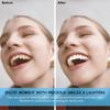 MXRFACTory Dentures Instant Veneers Snap On Tooth Cosmetic Silicone Tooth Whitening Temporary Prosthesis Teeth Reusable Top Bottom False Dental Braces Covering for Men and Women,1pairs view 2