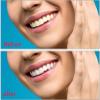 MXRFACTory Fake Teeth Instant Veneers Natural Tones Top Bottom Dentures Silicone Temporary Dentures Reusable Teeth Braces Covering for Men and Women Fix Your Teeth and Smile Fast,11pairs view 2