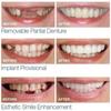 MXRFACTory Fake Teeth Instant Veneers Silica Gel Teeth Top Bottom Dentures Silicone Tooth Reusable Temporary Dentures Teeth Braces Covering for Men and Women For Bad Teeth,4pairs view 4