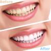 MXRFACTory Fake Teeth Instant Veneers Teeth Detachable Top Bottom Silicone Tooth Dental Prostheses Temporary Dentures Teeth Braces Covering for Men and Women Denture Restoration Kit,8pairs view 2