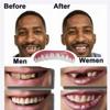 MXRFACTory Dental Prosthesis Instant Veneers Natural Tones Temporary Top Bottom Dentures Cosmetic Dental Comfort Fit Snap on Teeth Whitening For Bad Teeth Broken Teeth Men and Women,3pairs view 4