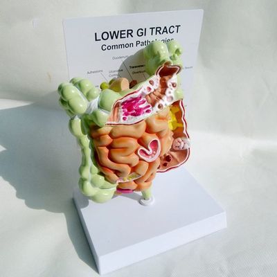 UIGJIOG Gastrointestinal model Colorectal lesion model intestinal disease Intestinal pathology model