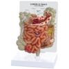 UIGJIOG Gastrointestinal model Colorectal lesion model intestinal disease Intestinal pathology model view 2