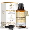 AVD Organics Frankincense Essential Oil 30ml - 100% Pure and Natural - Therapeutic Grade Essential Oil for Skin, Home Fragrance, 1fl. Oz view 2
