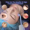5 in 1 High F Requency Facial Wand Machine Portable Beauty Device Massager Tool (Valentine's Day/Mother's Day Gift) view 3