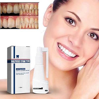 Calculusfree Dissolving Dental Spray, Mouth Refreshing Spray, Dental Calculus Remover Teeth Cleaner, Intensive Stain Removal Toothpaste (1 Pcs)
