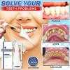 Calculusfree Dissolving Dental Spray, Mouth Refreshing Spray, Dental Calculus Remover Teeth Cleaner, Intensive Stain Removal Toothpaste (1 Pcs) view 4