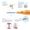 Curasept Proxi Treatment T17 Cone Interdental Brush, 6 Brushes view 2
