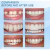 SUNDEER False Teeth Tooth Repair Granules, Temporary Kits, DIY Moldable - Beads, Bonding Kit for Fix The Missing and Broken Tooth, Instantly Confident Smile (2PC) view 3