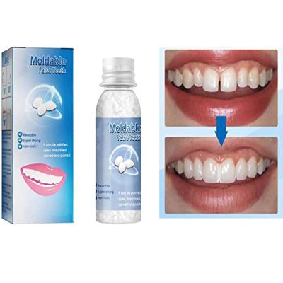 Tooth Repair Granules, Temporary Tooth Repair Kit, Moldable False Teeth, Temporary Tooth Repair Kit for Filling The Missing Broken Tooth, Broken Tooth Adhesive New Tooth Repair (2pcs-10ml)