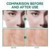 Advanced Silicone Scar Gel, Scar Removal Cream Gel, Stretch Mark Cream, Scar Cream for Old and New Scars, C-Section, Keloid, Acne Scar, Tummy Tuck, Burn, Surgery, Gentle with Vitamin E & Retinol view 2