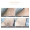 Home Use Portable Handy Laser IPL Hair Removal Cartridge Face & Body Painless Laser Hair Cutter Removal Machine (Rose) view 3