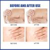 7 Line Correcting Silicone Scar Sheets Silicone Scar Sheets For Breast 8 Pack Breast Reduction After For Scar Removal Sheets 4 Areola Soft Strips 4 Sheets 2023 Graduation Gift view 4