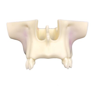 Life -Size Dental Implant Model, Training Teeth Model Maxillary Sinus Lifting Training Model, Doctor-Patient Communication Dental Teeth Implant Model Teeth Dental (A)
