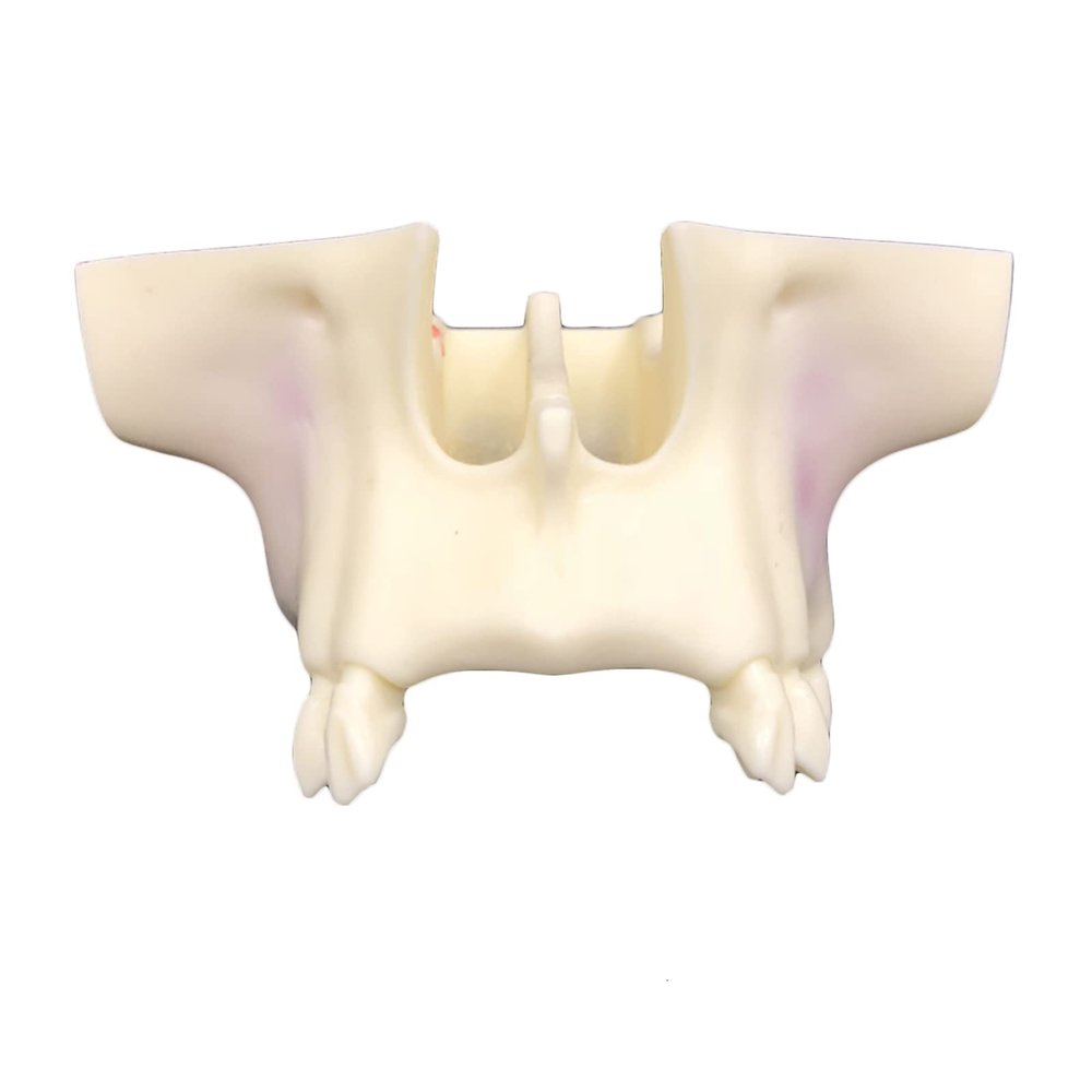 Life -Size Dental Implant Model, Training Teeth Model Maxillary Sinus Lifting Training Model, Doctor-Patient Communication Dental Teeth Implant Model Teeth Dental (A)