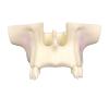 Life -Size Dental Implant Model, Training Teeth Model Maxillary Sinus Lifting Training Model, Doctor-Patient Communication Dental Teeth Implant Model Teeth Dental (A) view 1
