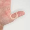 ArthroEze Oval Peach Thumb Splint For Trigger Thumb - Mallet Thumb - Thumb Hypermobility - Thumb Arthritis Size 5.5-50.6mm CIRCUMFERENCE view 1