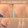 1 Box/12Pcs Copper Tag Remover Wart Tag Copper Tag Out Tag Removal Tool view 2