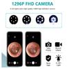 Dia 3.9mm WiFi HD 1080P Ear Cleaner Otoscope Endoscope Ear Spoon Ear Wax Cleaner USB Load Otoscope,Wi -Fi Visible Wax Elimination Spoon (White +8PCs Ear Wax Spoon) view 4