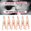 1 Box/12Pcs Copper Tag Remover Wart Tag Copper Tag Out Tag Removal Tool view 2