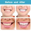 Denture Teeth Temporary Fake Teeth Snap On Top and Bottom for Men and Women, Fix Confident Smile view 2
