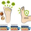 120pcs Athlete's Foot Between Toes Care Fungus Odor Treatment Absorbing Sweat view 4
