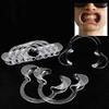 3pcs Autoclavable Dental Teeth Whitening Lip & Cheek Retractor Dentist Mouth Opener Repeat, S view 2