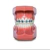 Snapcaps Braces Bumper Cover, Orthodontic Bracket Wax Substitute, Alternative Snap-on Braces Guard Braces Accessories 10 pack (Butterfly) view 3