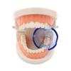 Fopytu 5 Pcs Dental Mouth Retractor Pipe Expander Mouth Opener for Front Teeth as Physician's Clinic Mouth Care view 2