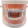 Fopytu 5 Pcs Dental Mouth Retractor Pipe Expander Mouth Opener for Front Teeth as Physician's Clinic Mouth Care view 4