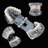 UIGJIOG Dental Tooth Model Dental Implant Model Dental Pathologies Adults Transparent Dentist Demonstration Periodontal Disease Love of Teeth Care Teeth Removable Model view 1