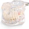 UIGJIOG Dental Tooth Model Dental Implant Model Dental Pathologies Adults Transparent Dentist Demonstration Periodontal Disease Love of Teeth Care Teeth Removable Model view 3