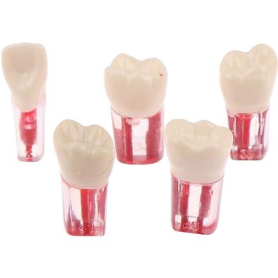 Baokuan 5pcs Resin Dental Endodontic Tooth Model Endo Root Canal Files Pulp Practice Study Endo Training Tooth Rct Demo Student Teaching