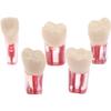 Baokuan 5pcs Resin Dental Endodontic Tooth Model Endo Root Canal Files Pulp Practice Study Endo Training Tooth Rct Demo Student Teaching view 1