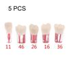 Baokuan 5pcs Resin Dental Endodontic Tooth Model Endo Root Canal Files Pulp Practice Study Endo Training Tooth Rct Demo Student Teaching view 3