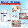 30ml Calculusfree Dissolving Dental Spray, Dental Calculus Remover Teeth Cleaner, Mouth Refreshing Spray, Intensive Stain Removal Toothpaste - Keep Breath Fresh for Whole Day (2pcs) view 4