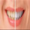 BioDenta Whitening Toothpaste Coconut + Mint, 75 ml - 98% Natural Vegan, Vegetarian and Halal Friendly. Free from SLS, PEG & Parabens view 3