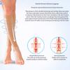 Compression Knee High Support Stocking Pain Relief Pressure Circulation Soft Varicose Vein Stocking Perfect for Sports Work Home Relapse Prevention Treatment of Varicose Veins,Black,XL (Flesh XL) view 4