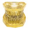 DYTAH Teeth Model - Tooth Extraction Orthodontic Exercise Model - Medical Educational Aid view 1