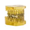 DYTAH Teeth Model - Tooth Extraction Orthodontic Exercise Model - Medical Educational Aid view 3