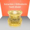 DYTAH Teeth Model - Tooth Extraction Orthodontic Exercise Model - Medical Educational Aid view 4