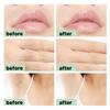 72 Strips Facial Wax Strips, Lady Wax Strips Hair Removal, Small Wax Strips for Facial Eyebrows, Upper Lip and Chin(4 Calming Oil Wipes) view 4