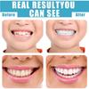 Wttfc 2 Pair Dentures Veneers Tooth, Fake Teeth Veneers Upper and Lower Snap on Veneers Teeth, Temporary Whitening Cosmetic Teeth Instant Veneers False Teeth Braces for Men and Women, with Box,A view 4