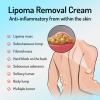CurSkin Lipoma Treatment Ointment,LumpFree Lipoma Removal Cream,Herbal Lipoma Lumps Removal Creams,Herbal Lipoma Elimination Cream,Get Rid of Your Fatty Lipoma Lumps view 4