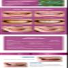 Tooth Whitening Solution Removes Stains Tooth Whitening Oral Hygiene Essence Toothpaste Cleaning Whitening Stains view 3